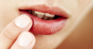 oral health lips